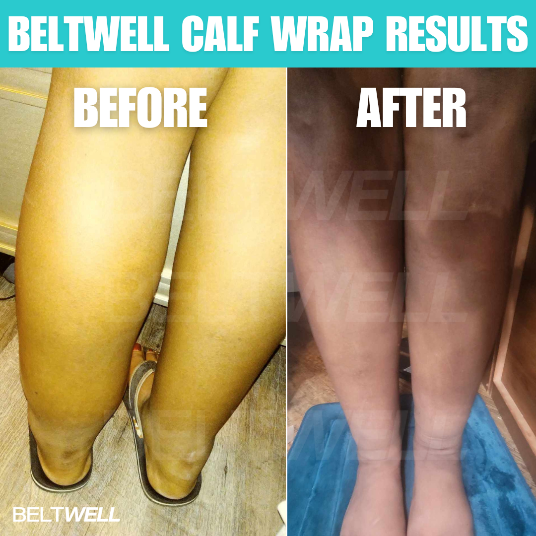 Beltwell® The Full Leg Compression Bundle (Foot, Calf, Thigh) + 8 FREE Bonuses