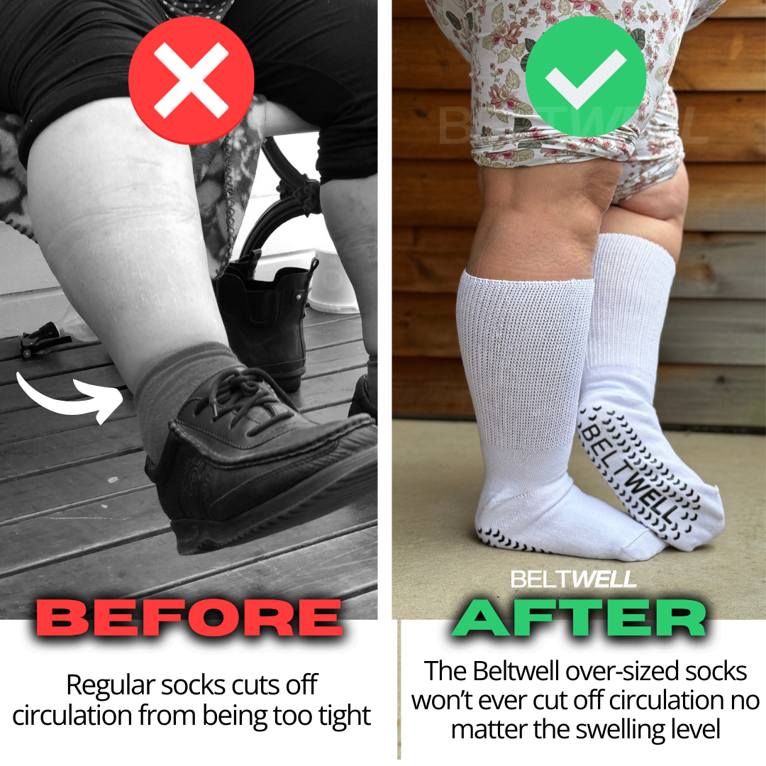 Beltwell® - The Oversized Circulation Socks For Swollen Legs & Feet (2 pairs)
