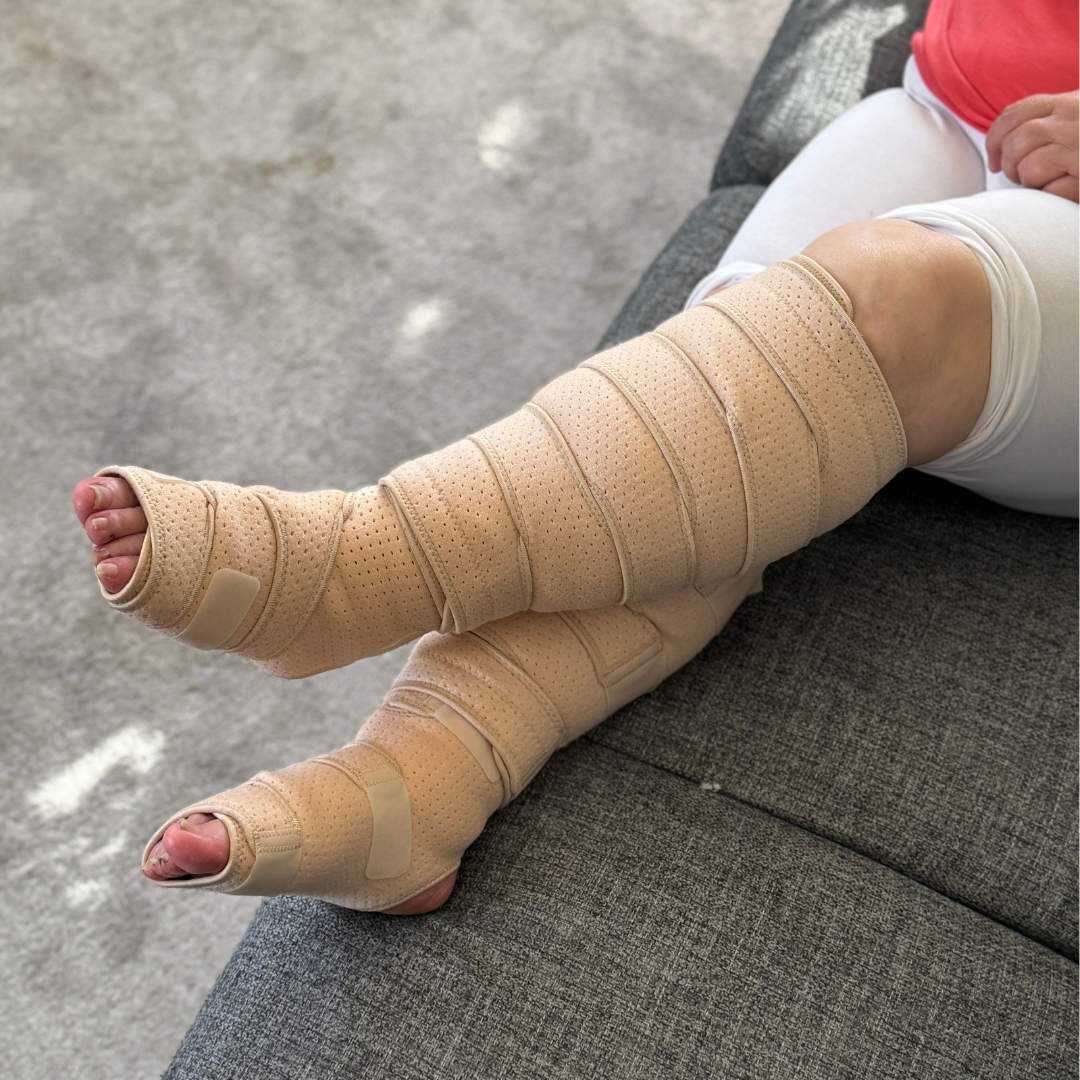 Beltwell® - The Full Foot & Calf Compression System For Swelling ...
